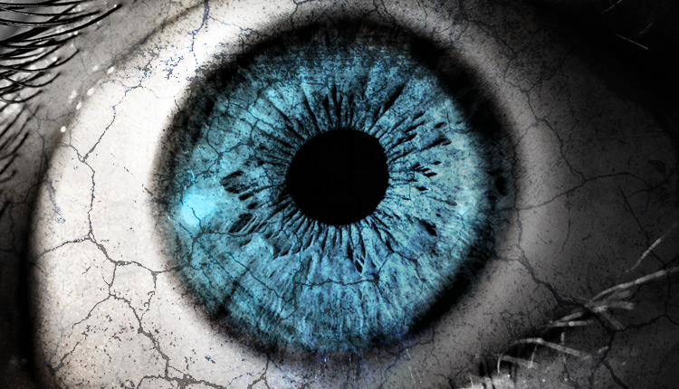 Dry Eye