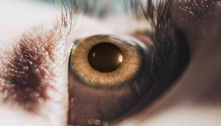 What You Should Know About Corneal Transplant Surgery
